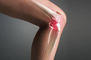 Боли в области колена при заболевании