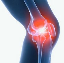 боли в колене при возникновении артрита